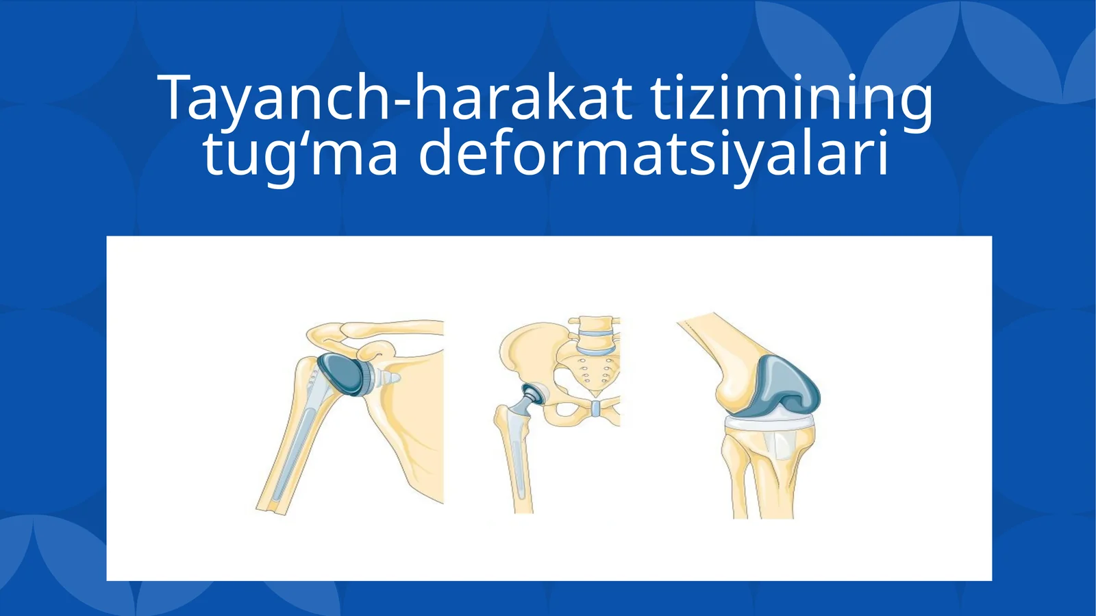 Tayanch-harakat tizimining tug‘ma deformatsiyalari