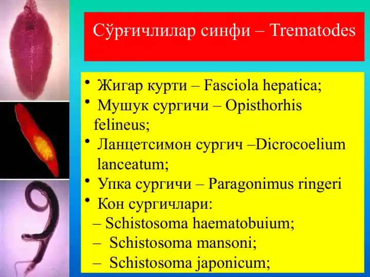 So'rg'ichlilar sinfi-Trematodes
