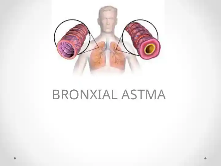 BRONXIAL ASTMA