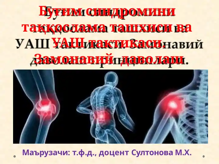 Буғимсиндроми ташхиси ва даволаш принциплари