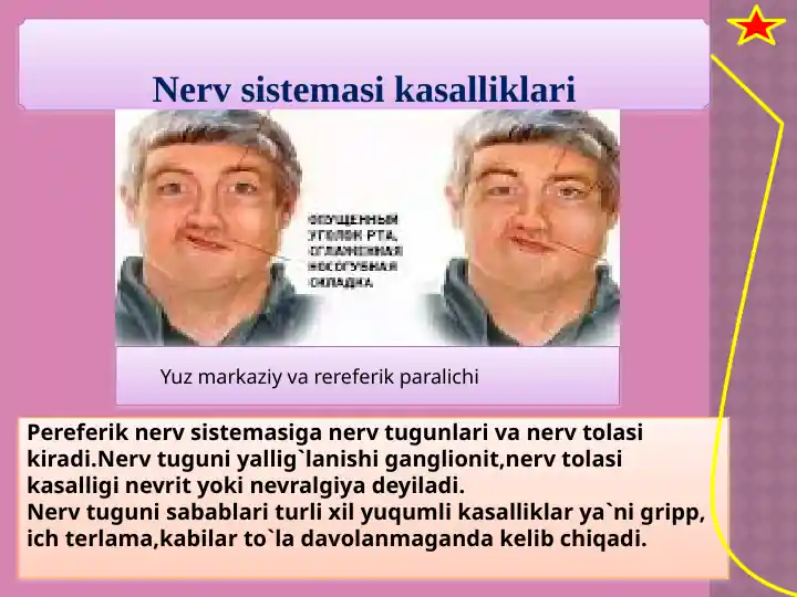 Nerv sistemasi kasalliklari