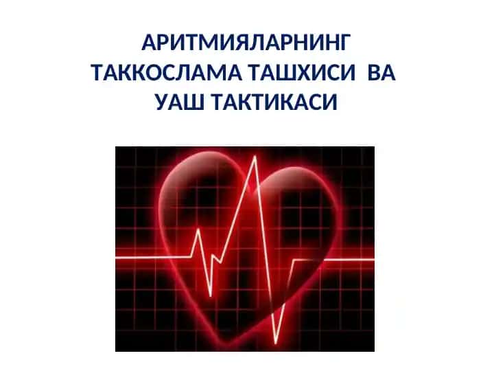 Аритмияларнинг таккослама ташхиси ва уш тақтикаси