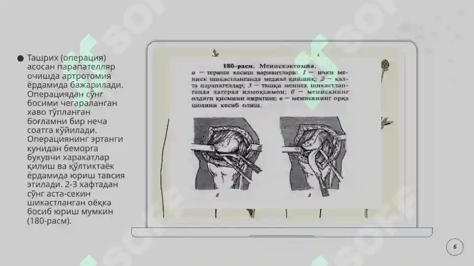 Product slide 6