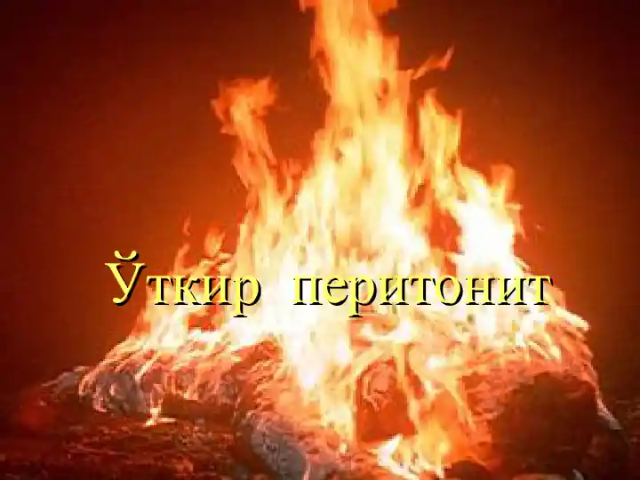 Ўткир перитонит
