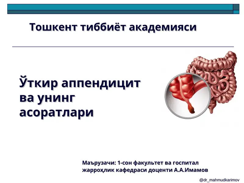 Ўткир аппендицит ва унинг асоратлари