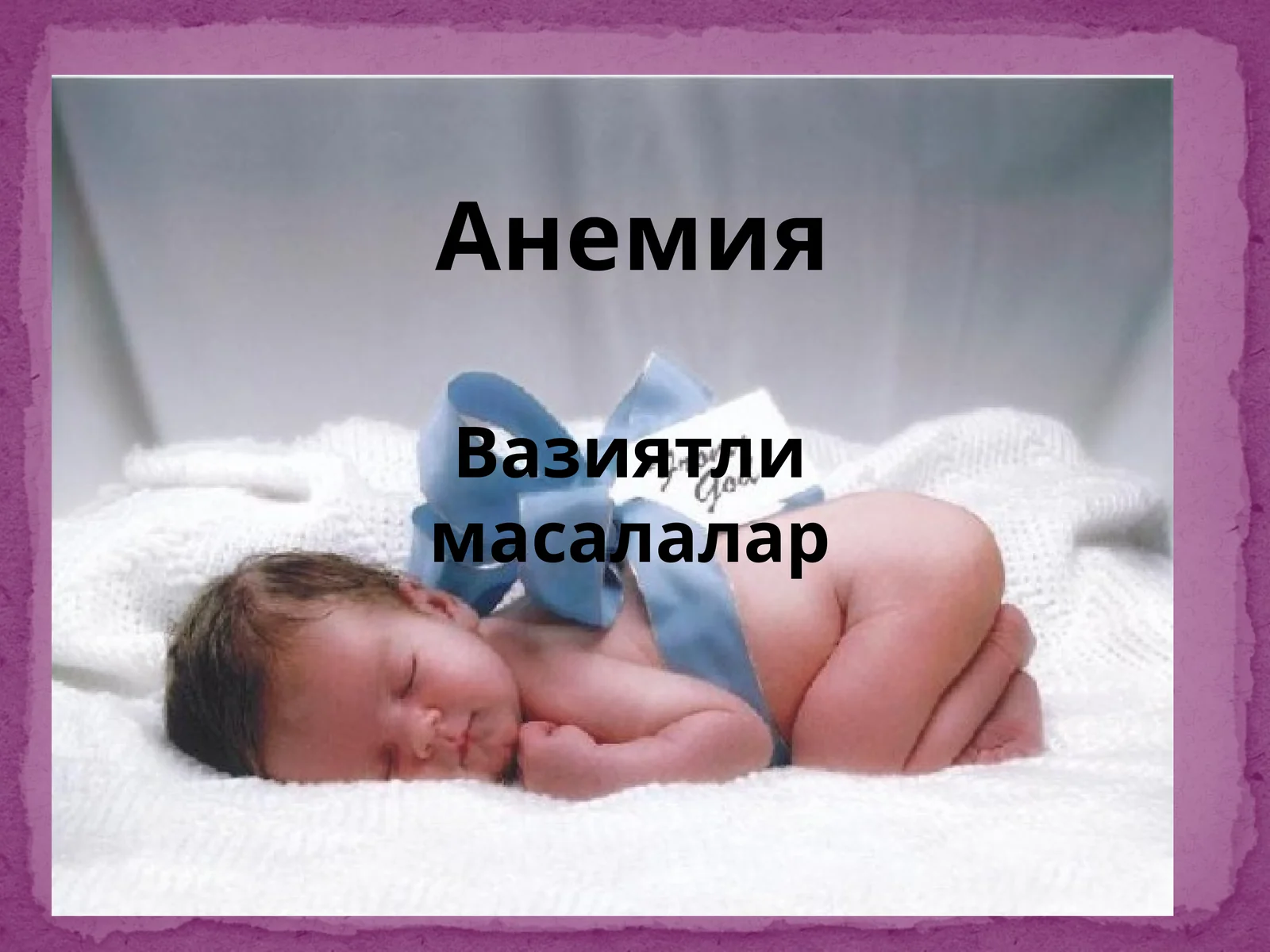 Анемия