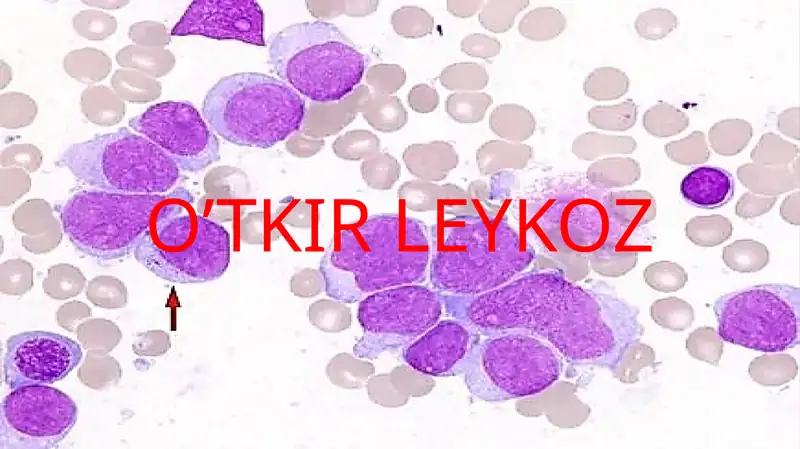 O’TKIR LEYKOZ