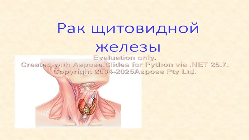 Рак щитовидной железы
