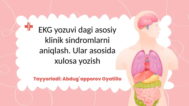 EKG yozuvi dagi asosiy klinik sindromlarni aniqlash. Ular asosida xulosa yozish