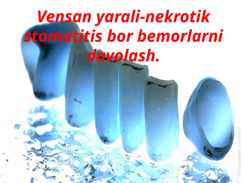 Vinsent Stomatiti